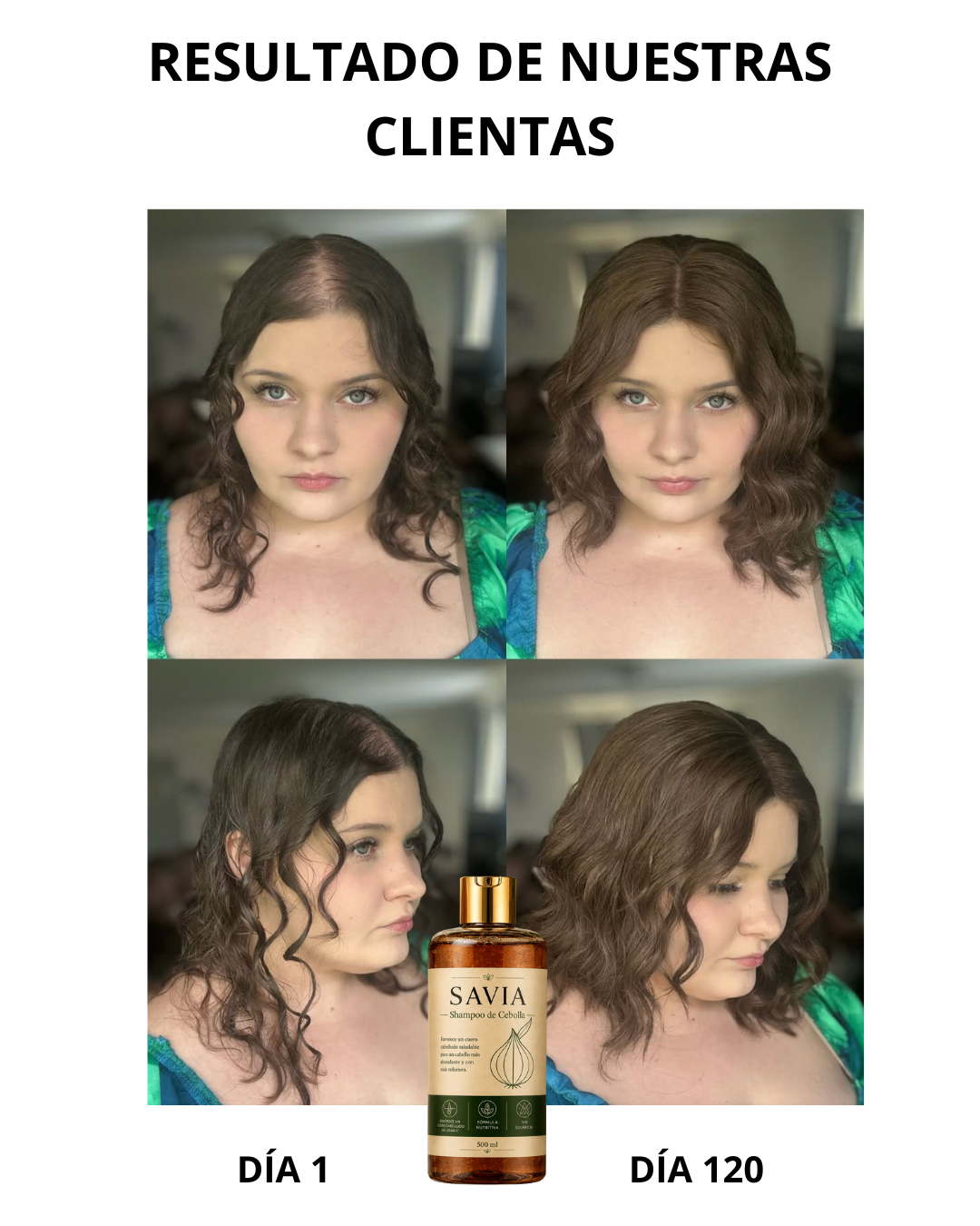 SAVIA - Shampoo hidrosol de cebolla - Activa los folîculos y reduce la caída