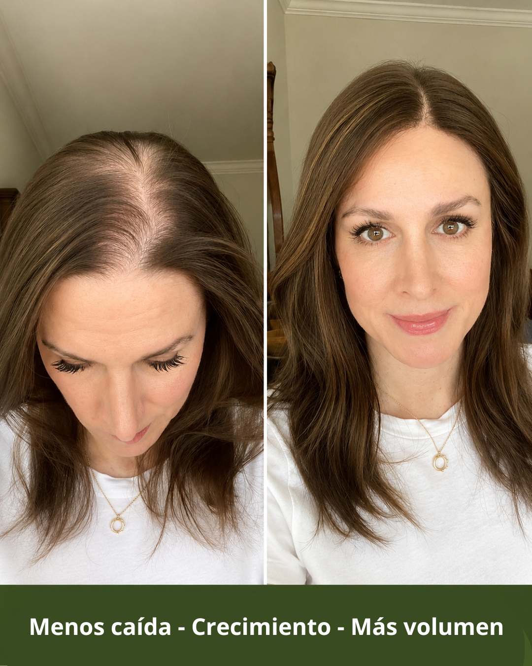 SAVIA - Shampoo hidrosol de cebolla - Activa los folîculos y reduce la caída