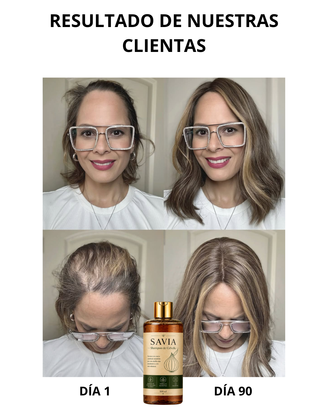 SAVIA - Shampoo hidrosol de cebolla - Activa los folîculos y reduce la caída